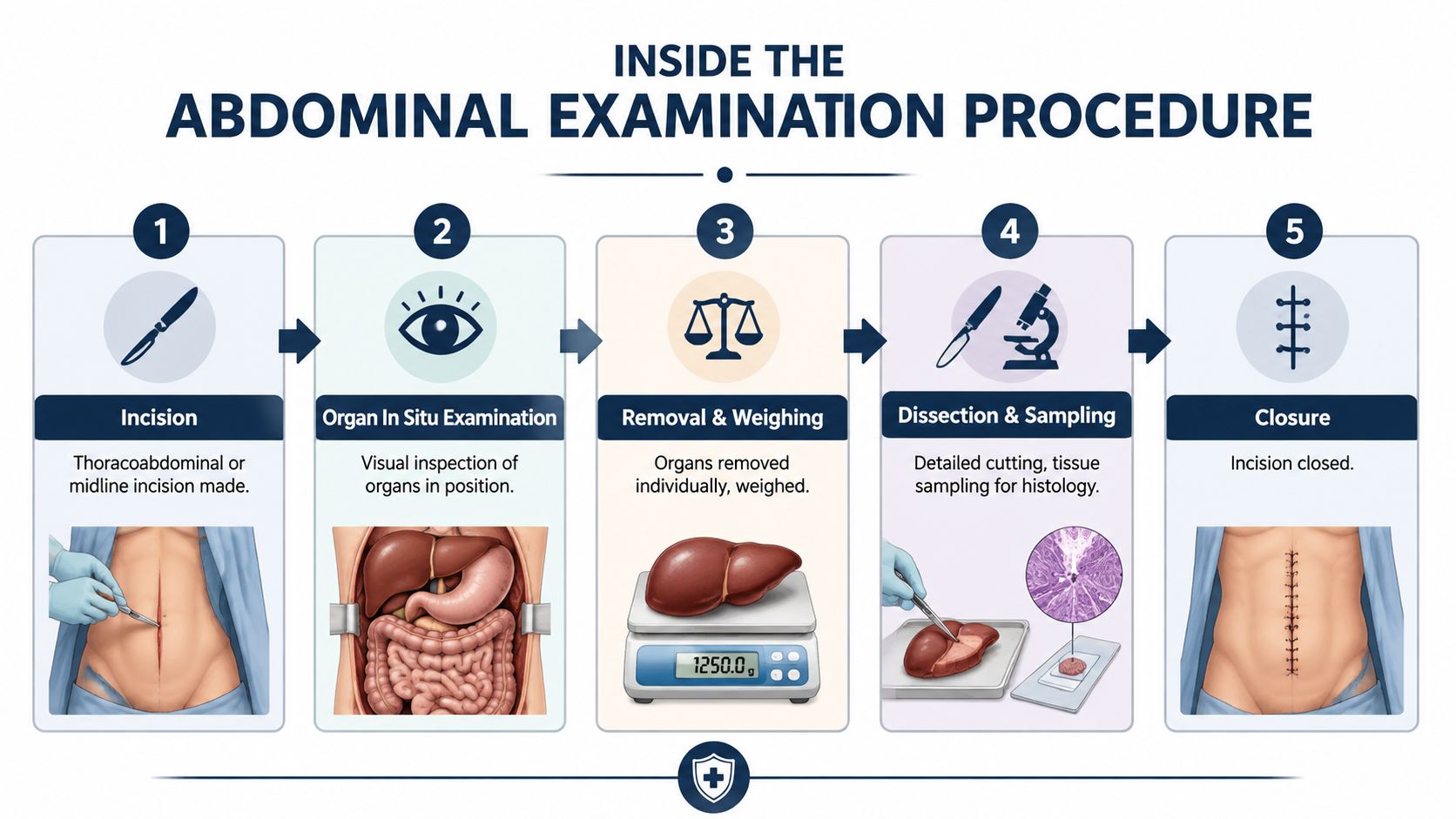An infographic detailing the five steps of an abdominal autopsy procedure from incision to final closure.